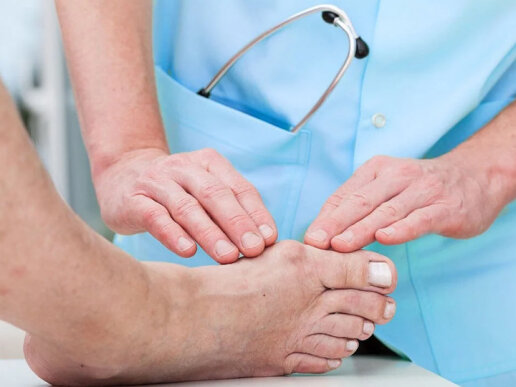 Як вилікувати вальгусну деформацію у дорослого?