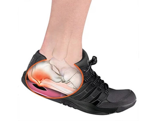 Яке взуття потрібно носити при шпорі п'яти?