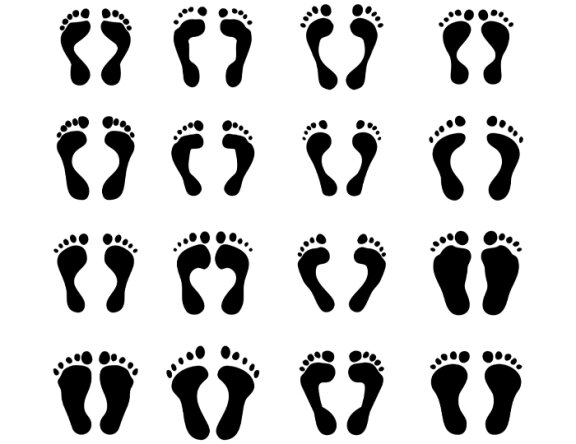 Як дізнатися, який рівень плоскостопості?