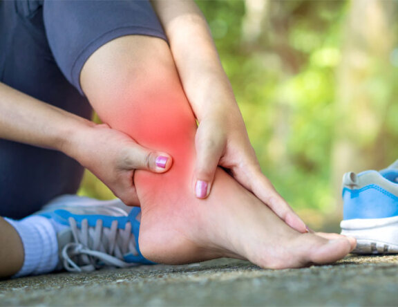 Как снять отек после растяжения ноги